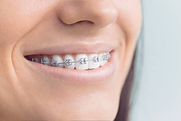 Best Traditional Braces  in Statesville, NC